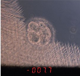 Embryon humain au début de la cristallisation